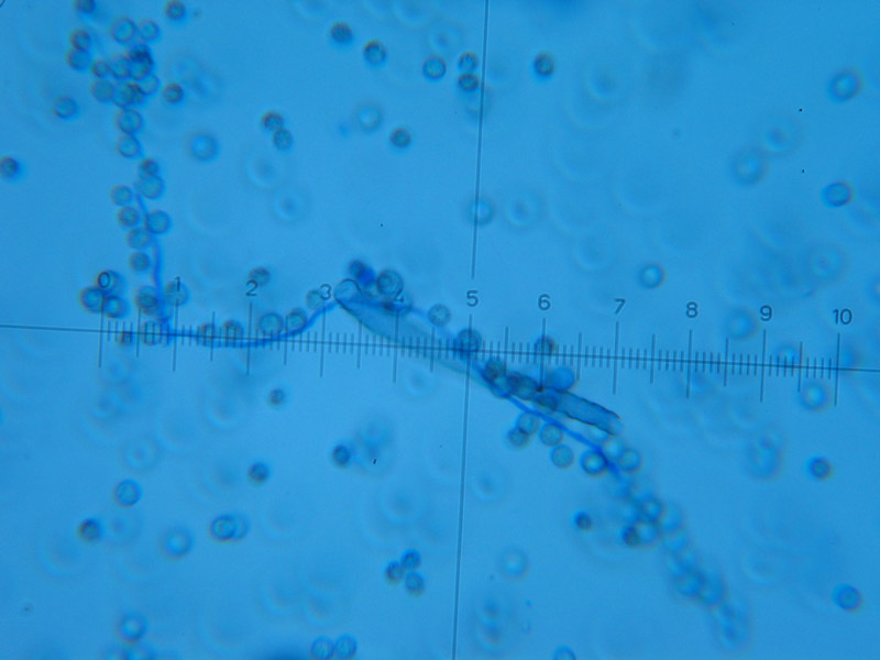 Lycogala epidendrum (J.C. Buxb. ex L.) Fr.(PROVA)